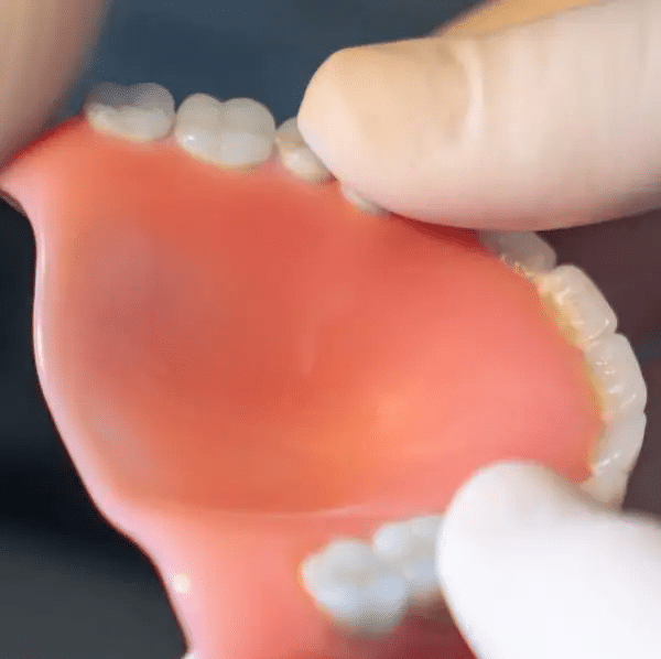 dentures and porcelain veneers