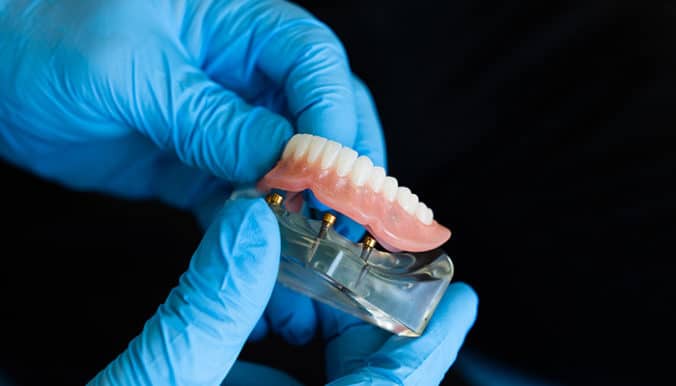 setting and testing new dentures on implant