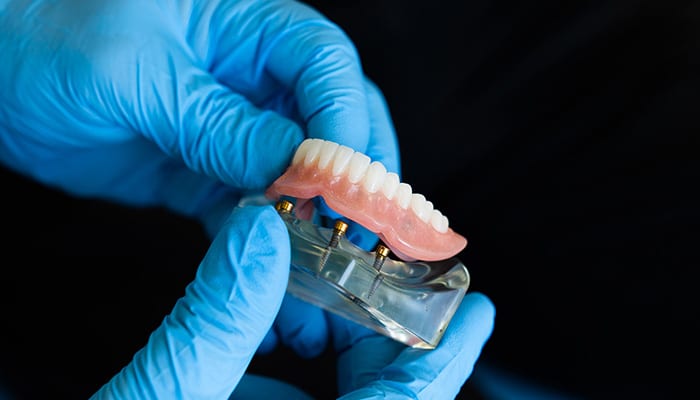 mobile denture clinic