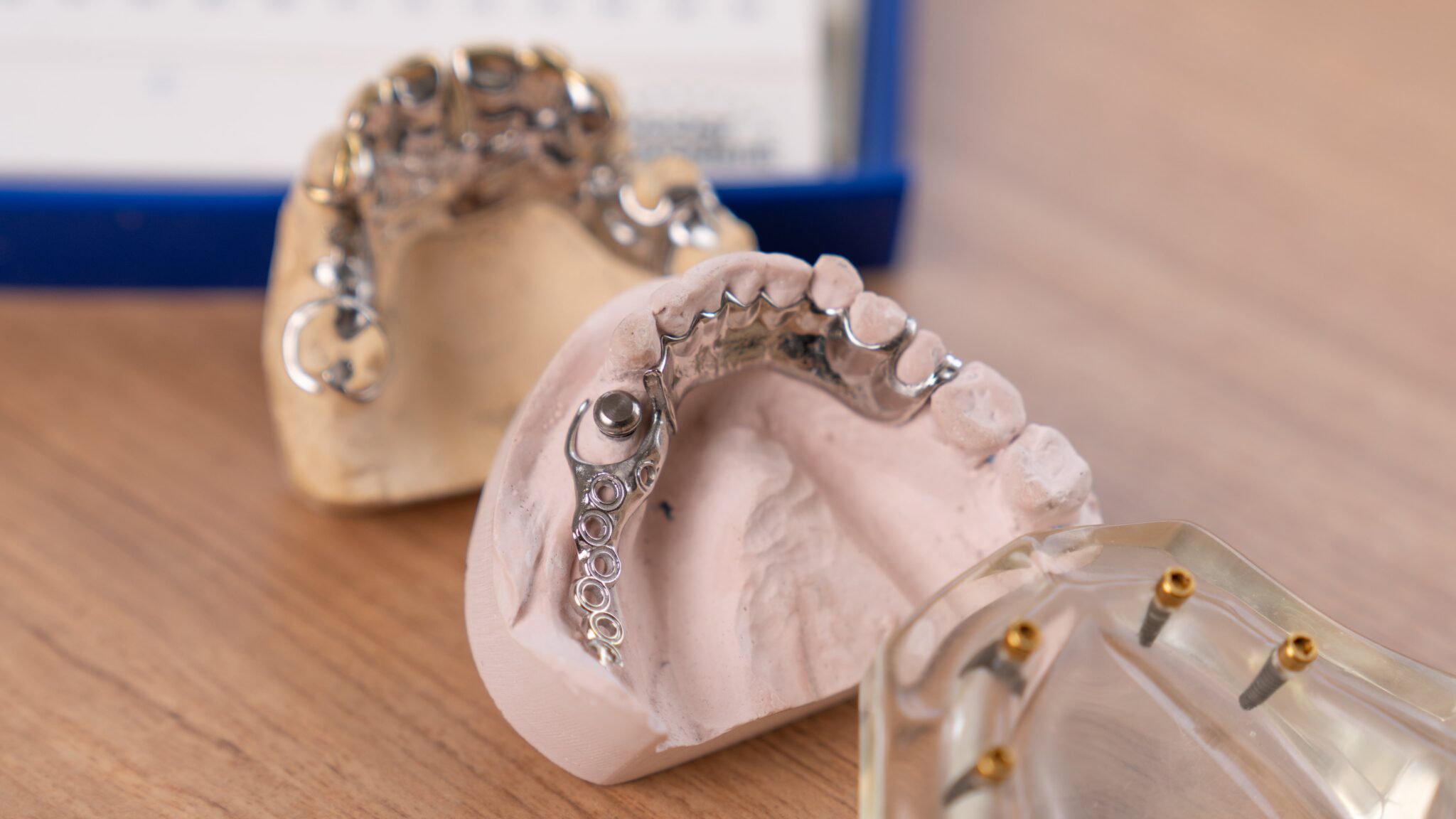 Can Implant-Retained Dentures Break or Need Repairs